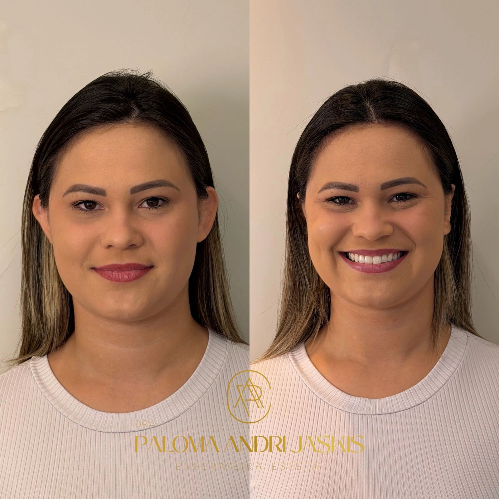 Antes e Depois 41